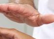 Technicien en Hypnose Ericksonienne
